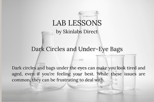 Dark Circles and Under-Eye Bags